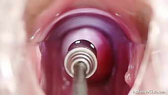 A Stunning Blonde Beauty Undergoes A Vaginal And Rectal Examination And Receives An Enema